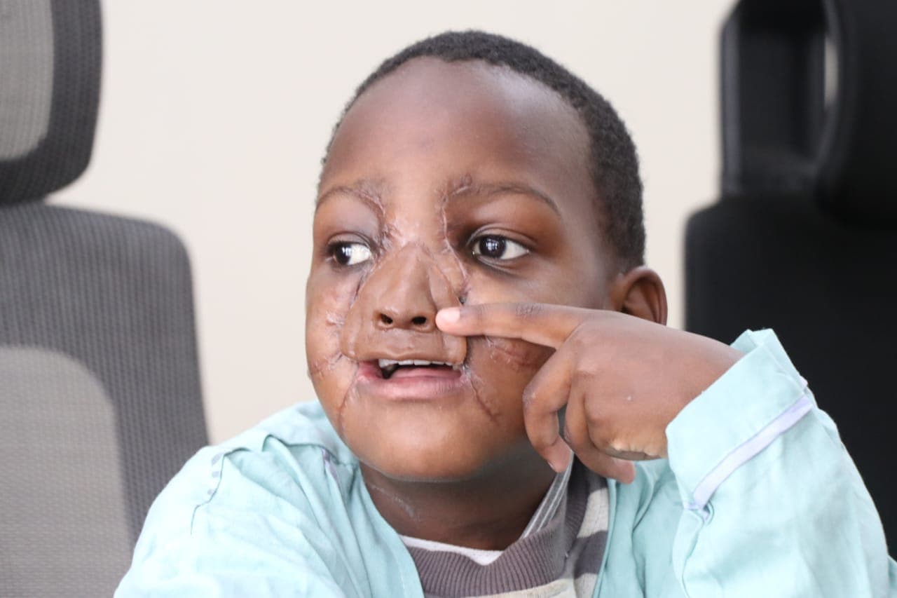 Kenyan Surgeons Make History with World’s First Reconstructive Surgery